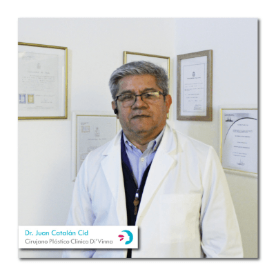 Abdominoplastia