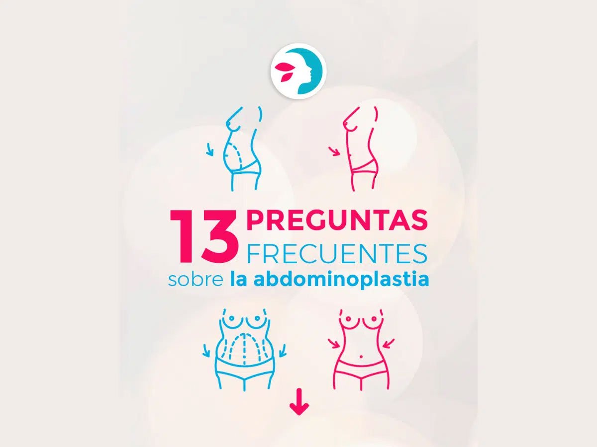 13-preguntas-sobre-la-abdominoplastia