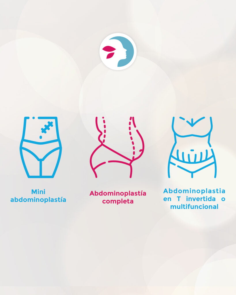 abdominoplastia