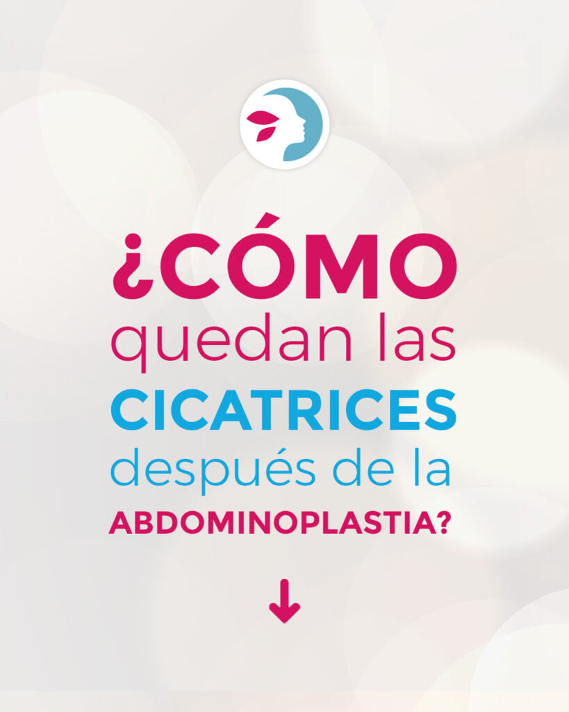 Cicatriz Abdominoplastia: Hablemos De La Sana Cicatrización