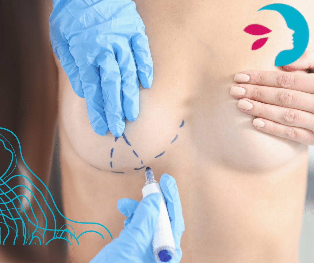 ¿Qué exámenes médicos se requieren para una cirugía de mastopexia