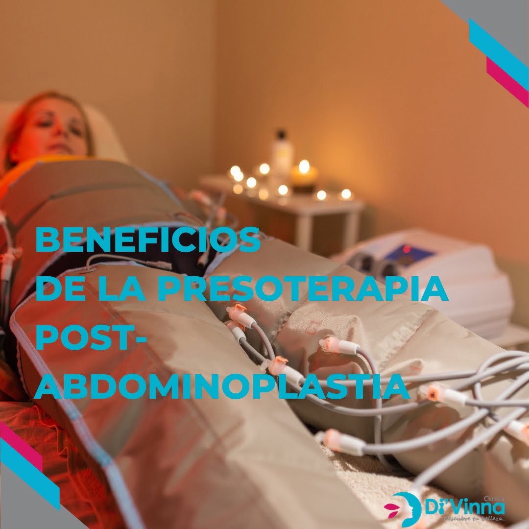 Beneficios de la Presoterapia Post-Abdominoplastia