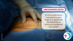 abdominoplastia portada