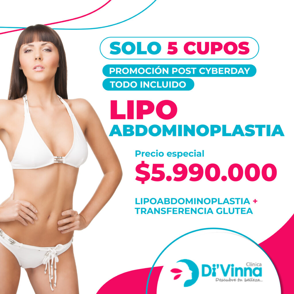 Abdominoplastia Abdominoplastia - lipoabdominoplastia