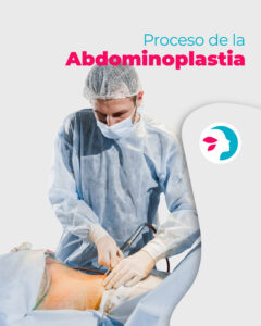 Abdominoplastia en Clinica divinna