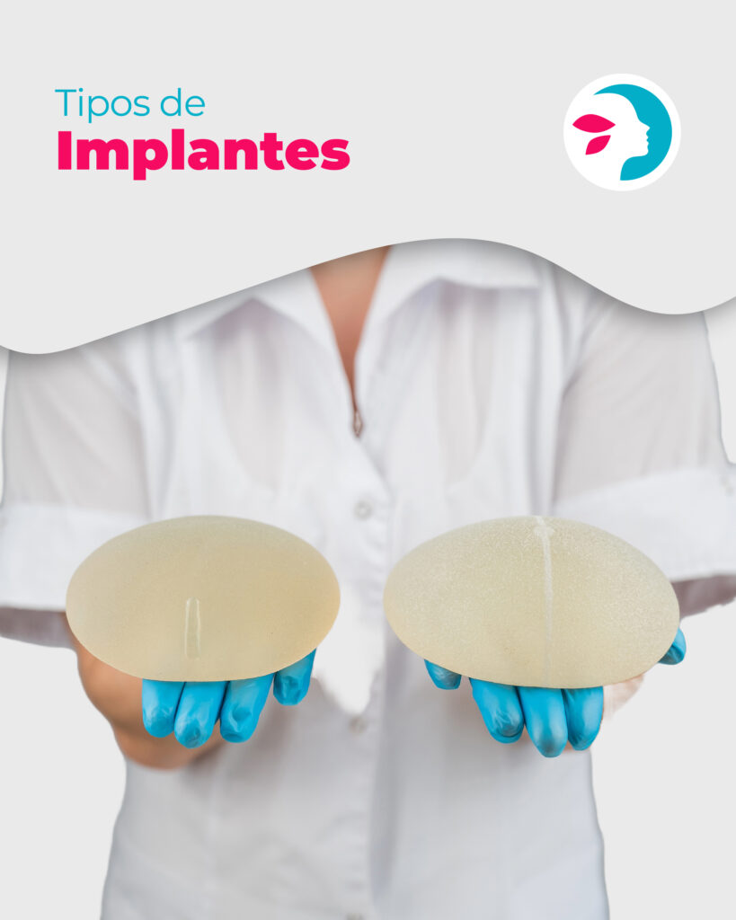 Mamoplastia de Aumento en Clínica Divinna: Todo lo que necesitas saber para una decisión segura y consciente Mamoplastia de Aumento