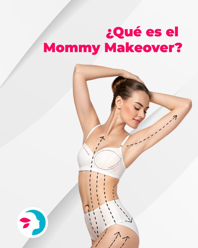 Mommy Makeover: cómo recuperar tu cuerpo y tu autoestima después de la maternidad Mommy Makeover cómo recuperar tu cuerpo